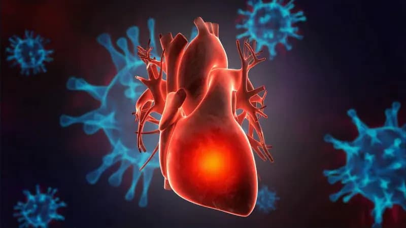2022 ACC Expert Consensus Decision Pathway on Cardiovascular Sequelae of COVID-19 in Adults